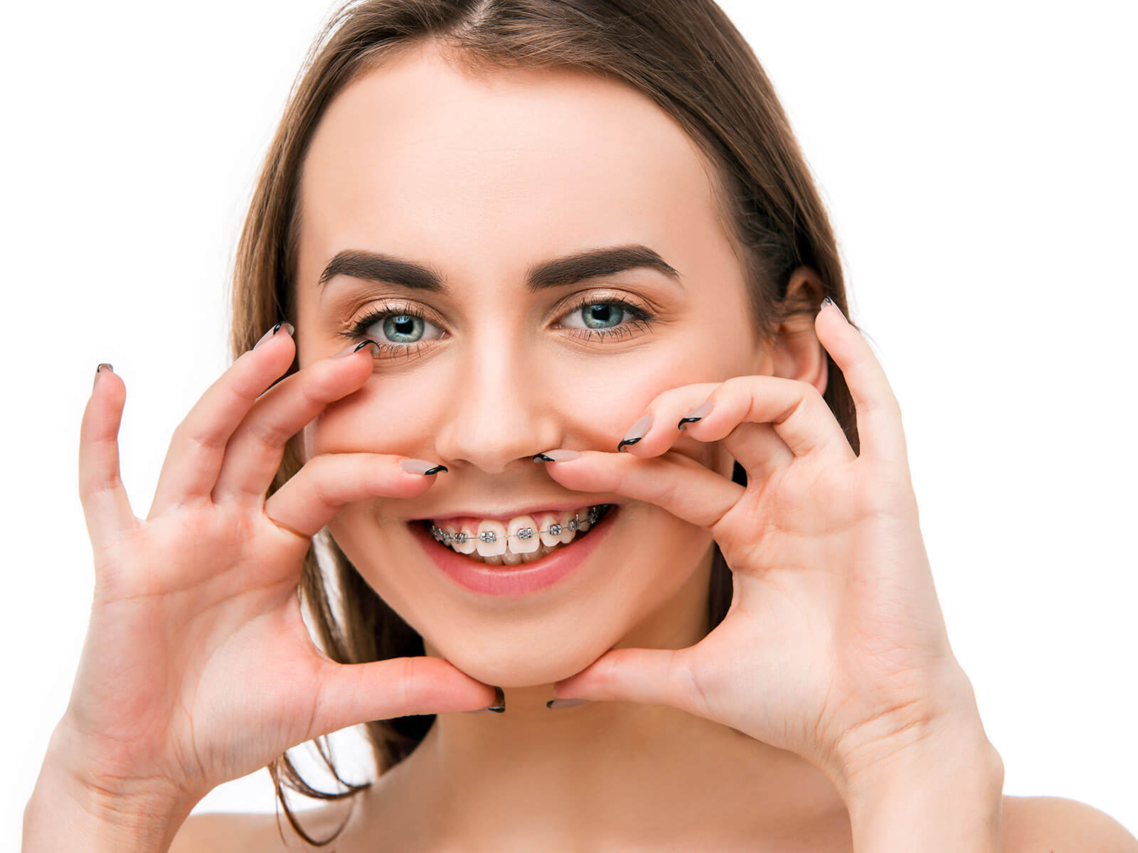 Can Orthodontics Fix Facial Asymmetry?